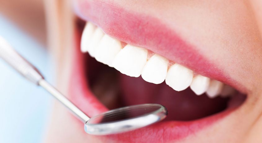 Здоровая улыбка-Ваша визитная карточка! 61% скидки на лечение пришеечного кариеса с установкой световой пломбы от стоматологии «на Пушкарской»