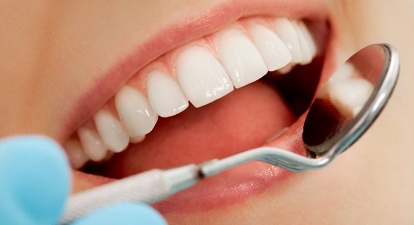 Скидка 70% на профессиональную чистку зубов ультразвуком и отбеливание Air Flow в стоматологической клинике «Стоматология 33»!