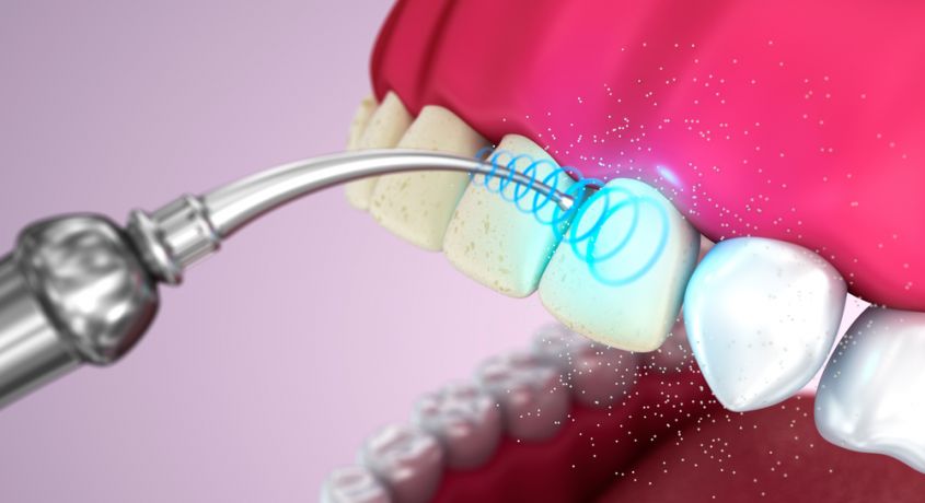 Здоровая улыбка — наш приоритет! Скидка 50% на профессиональную ультразвуковую чистку зубов от стоматологии «Айболит»