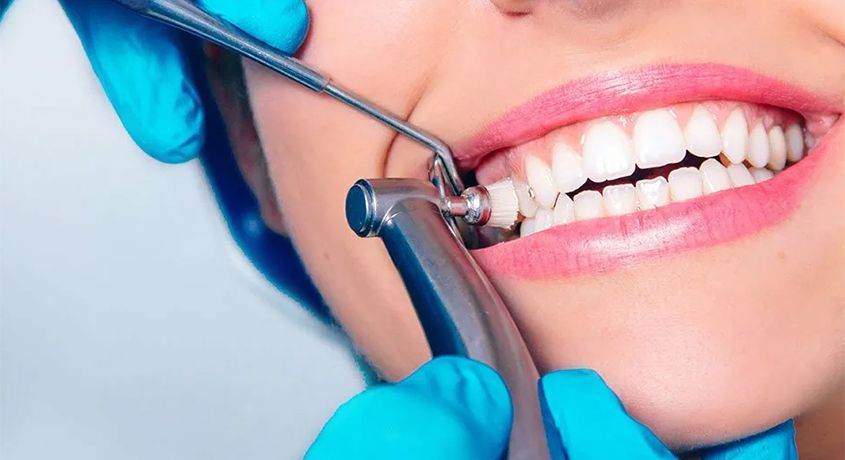 Улыбка вашей мечты! Скидка до 50% на профессиональную гигиену полости рта от стоматологии «Зубная фея».