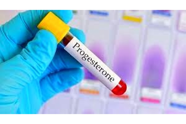 Анализ крови на прогестерон 