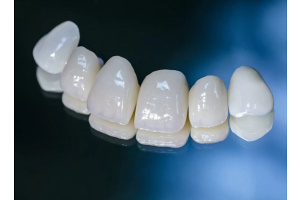 Коронка металлокерамическая на зуб 