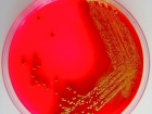 Посев спермы на микрофлору и чувствительность к антибиотикам