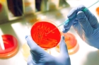 Посев секрета простаты на микрофлору и чувствительность к антибиотикам
