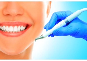 Профессиональная система очищения зубов (чистка с помощью системы AIR-FLOW, полирование зубов)