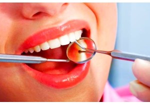Лечение пульпита 4-канального зуба