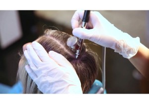 Восстановление роста волос ( Барофорез кожи головы 