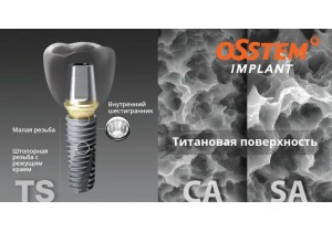 Импланты Osstem Implant (Осстем)