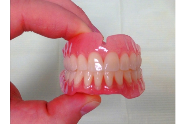 Изготовление акрилового протеза частичного съемного на один зуб