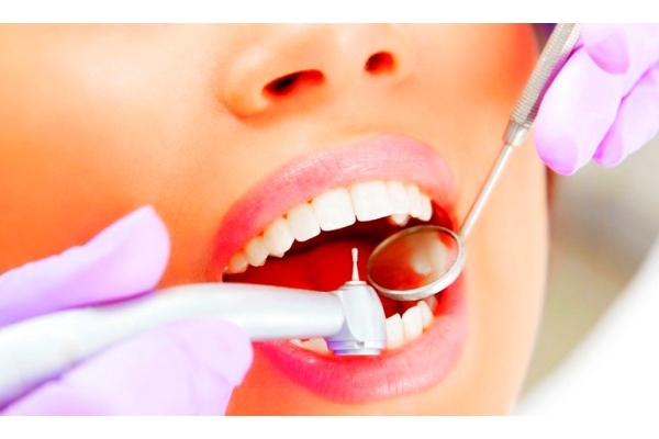 Обработка полости зуба после выпадения пломбы или скола