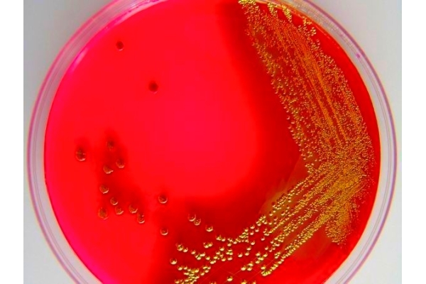 Посев спермы на микрофлору и чувствительность к антибиотикам