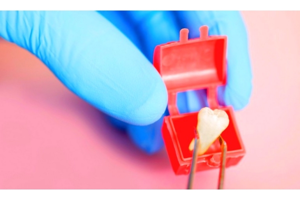 Удаление постоянного зуба сложное
