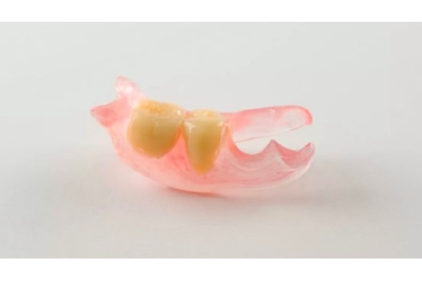 Изготовление частичного съемного акрилового протеза 1-2 зуба