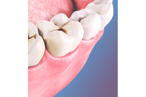 Лечение зубов Icon