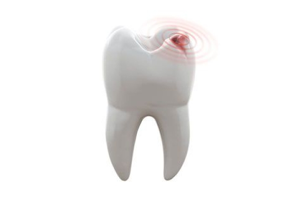 Лечение острой зубной боли