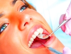 Глубокое фторирование эмали (1 зуб)