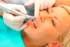Ультразвуковое удаление  назубных отложений (1 зуб)