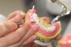 Изготовление нейлонового протеза частичного съемного (на 1 зуб)