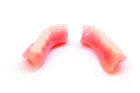 Починка съемного протеза (приварка двух зубов)