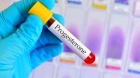 Анализ крови на прогестерон 
