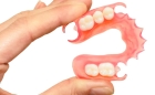 Гибкий съемный протез (Перфлекс,Вертекс) 1-4 зуба