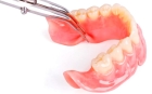 Приварка зуба к съемному протезу (Перфлекс, Акри-фри, Вертекс)