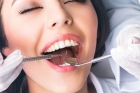 Пломбирование зубного канала пастой