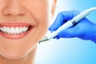 Профессиональная чистка зубов Air Flow (1 зуб)