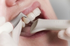 Профессиональная чистка зубов Air Flow (1 челюсть)