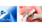 Профессиональная чистка зубов ультразвук система Air-flow