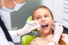  Фторирование зубов детям