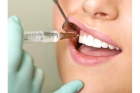 Лечение постоянных зубов