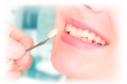 Композитная реставрация зуба