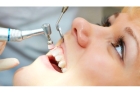Протезирование передних зубов на имплантах