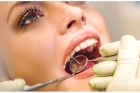 Услуги протезирования зубов на имплантах