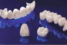Недорогие циркониевые коронки на зубы