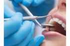 Лечение зубов  в рассрочку