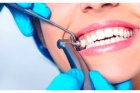Профессиональная гигиена полости рта и зубов