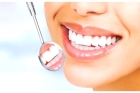Ультразвуковое удаление наддесневых и поддесневых зубных отложений в области зуба 