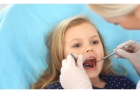Восстановление зуба пломбой I, II, III, V, VI класс по Блэку (Цемилайт)