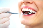 Восстановление зуба пломбой VI класс по Блэку ( винир)   