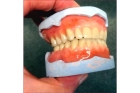 Полный зубной протез