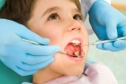 Лечение пульпита постоянного зуба (1 канал) + полная реставрация