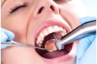 Лечение пульпита постоянного зуба (3 канала) + частичная реставрация (1 посещение)