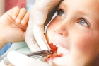 Лечение периодонтита постоянного зуба (1 канал)+ частичная реставрация (1 посещение)
