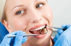 Лечение пульпита 4 канальный зуб