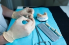 Протезирование частичной потери зубов