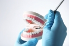 Протезирование зубов верхней челюсти