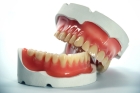 Протезирование зубов на импланте циркониевой коронкой