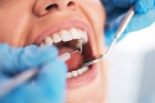 Лечение кариеса депульпированного зуба 